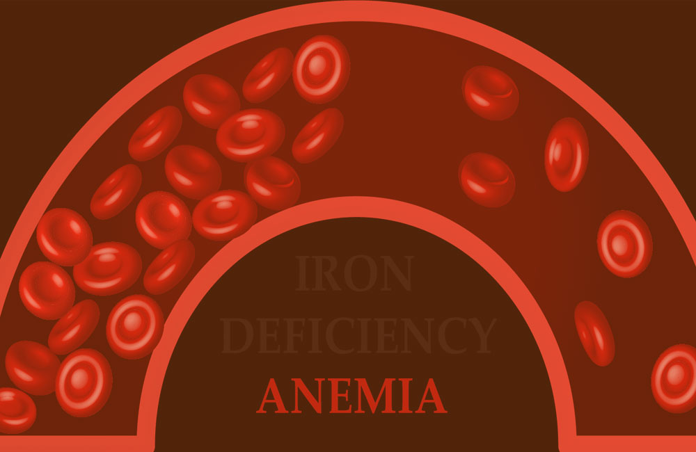 iron-deficiency-anemia-how-can-a-blood-test-help