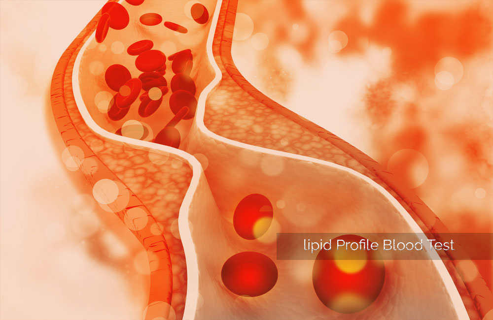 How important is a lipid profile blood test?